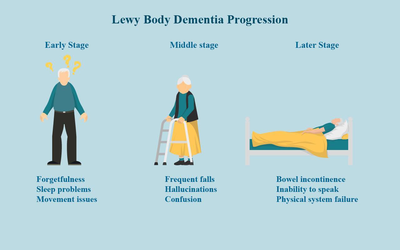 Lewy Body Dementia (LBD): What It Is, Symptoms & Treatment